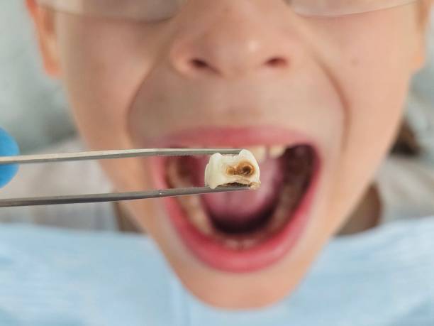 Best Emergency Dental Services for Seniors in Ada, OH
